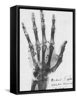 X-ray of a hand with buckshot-Science Source-Framed Stretched Canvas