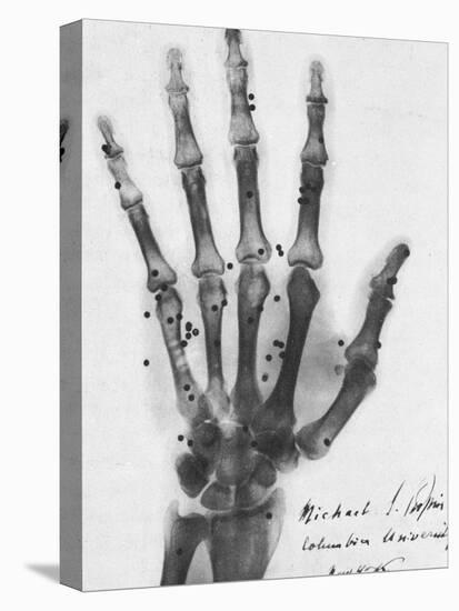 X-ray of a hand with buckshot-Science Source-Stretched Canvas