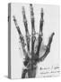 X-ray of a hand with buckshot-Science Source-Stretched Canvas