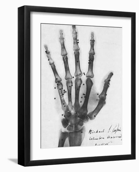 X-ray of a hand with buckshot-Science Source-Framed Giclee Print