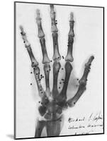 X-ray of a hand with buckshot-Science Source-Mounted Giclee Print