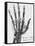 X-ray of a hand with buckshot-Science Source-Framed Stretched Canvas