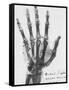 X-ray of a hand with buckshot-Science Source-Framed Stretched Canvas