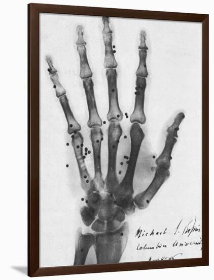 X-ray of a hand with buckshot-Science Source-Framed Giclee Print