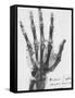 X-ray of a hand with buckshot-Science Source-Framed Stretched Canvas