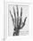 X-ray of a hand with buckshot-Science Source-Framed Giclee Print