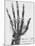 X-ray of a hand with buckshot-Science Source-Mounted Giclee Print