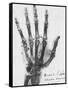 X-ray of a hand with buckshot-Science Source-Framed Stretched Canvas