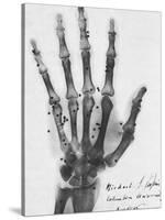 X-ray of a hand with buckshot-Science Source-Stretched Canvas