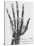 X-ray of a hand with buckshot-Science Source-Stretched Canvas
