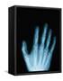 X-Ray of a Hand-Robert Llewellyn-Framed Stretched Canvas