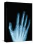 X-Ray of a Hand-Robert Llewellyn-Stretched Canvas