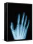 X-Ray of a Hand-Robert Llewellyn-Framed Stretched Canvas