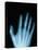 X-Ray of a Hand-Robert Llewellyn-Stretched Canvas