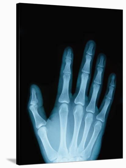 X-Ray of a Hand-Robert Llewellyn-Stretched Canvas