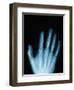 X-Ray of a Hand-Robert Llewellyn-Framed Premium Photographic Print
