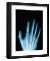 X-Ray of a Hand-Robert Llewellyn-Framed Premium Photographic Print