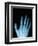 X-Ray of a Hand-Robert Llewellyn-Framed Premium Photographic Print