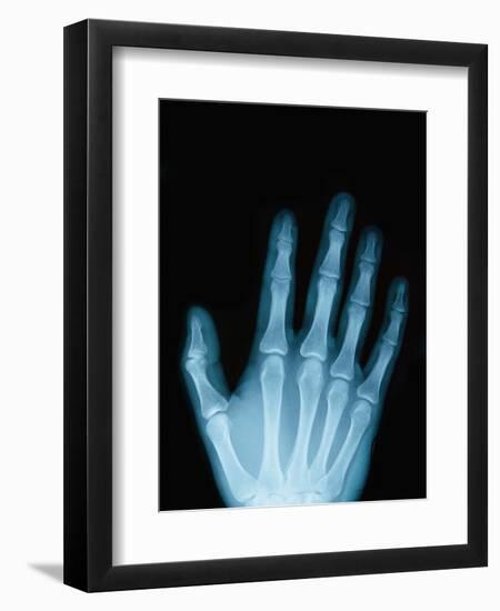 X-Ray of a Hand-Robert Llewellyn-Framed Premium Photographic Print