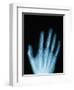 X-Ray of a Hand-Robert Llewellyn-Framed Premium Photographic Print