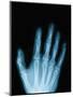 X-Ray of a Hand-Robert Llewellyn-Mounted Premium Photographic Print