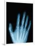 X-Ray of a Hand-Robert Llewellyn-Framed Photographic Print