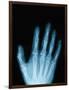 X-Ray of a Hand-Robert Llewellyn-Framed Photographic Print