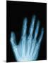 X-Ray of a Hand-Robert Llewellyn-Mounted Photographic Print