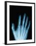 X-Ray of a Hand-Robert Llewellyn-Framed Photographic Print