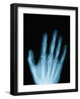 X-Ray of a Hand-Robert Llewellyn-Framed Photographic Print