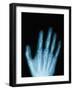 X-Ray of a Hand-Robert Llewellyn-Framed Photographic Print