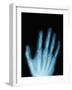 X-Ray of a Hand-Robert Llewellyn-Framed Photographic Print