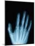 X-Ray of a Hand-Robert Llewellyn-Mounted Photographic Print
