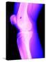 X-Ray of a Knee-null-Stretched Canvas