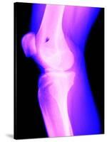 X-Ray of a Knee-null-Stretched Canvas