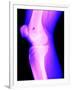 X-Ray of a Knee-null-Framed Premium Photographic Print