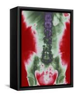 X-ray of a Torso-null-Framed Stretched Canvas