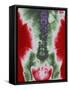 X-ray of a Torso-null-Framed Stretched Canvas