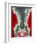 X-ray of a Torso-null-Framed Photographic Print