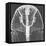 X-ray of an Egyptian Mask-Science Source-Framed Stretched Canvas