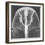 X-ray of an Egyptian Mask-Science Source-Framed Giclee Print