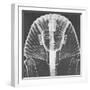 X-ray of an Egyptian Mask-Science Source-Framed Giclee Print