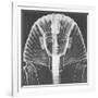 X-ray of an Egyptian Mask-Science Source-Framed Giclee Print