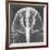 X-ray of an Egyptian Mask-Science Source-Framed Giclee Print