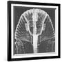 X-ray of an Egyptian Mask-Science Source-Framed Giclee Print