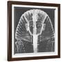 X-ray of an Egyptian Mask-Science Source-Framed Giclee Print