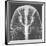 X-ray of an Egyptian Mask-Science Source-Framed Giclee Print