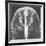 X-ray of an Egyptian Mask-Science Source-Framed Giclee Print