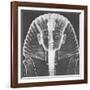 X-ray of an Egyptian Mask-Science Source-Framed Giclee Print