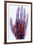 X-ray of Blood Vessels-Science Source-Framed Giclee Print